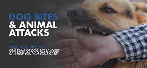 dog bite attorney name 35157