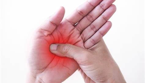 Acute Pain in Palm of Hand. Stock Image - Image of body, muscle: 32857921