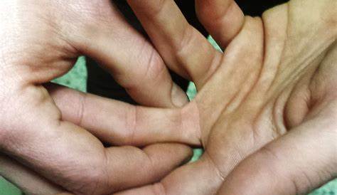Dolor en la articulación del dedo gordo de la mano - Ortoeco