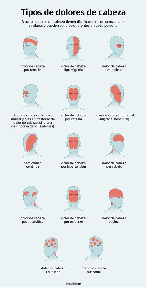 ¿Sabes Por Qué Sientes Dolor de Cabeza Constantemente? Descubre las Causas y Soluciones Efectivas