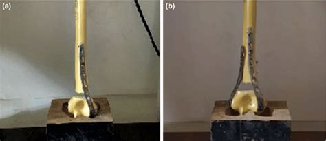 double penetration fixation 5