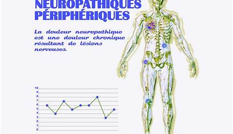 Traitement d’acupuncture pour douleurs neuropathiques | Clinique Lajeunesse