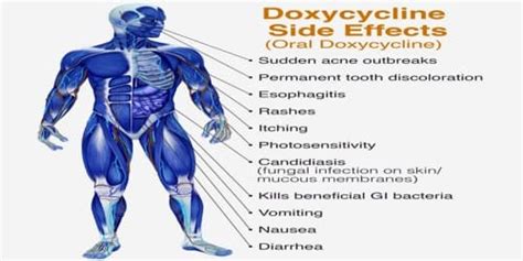 Doxy Side Effects: What You Need to Know Today