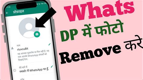Dp Remove Status