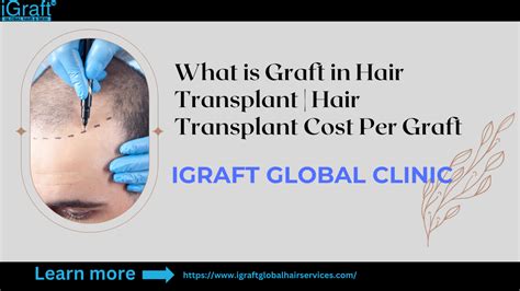 dr diep cost per graft