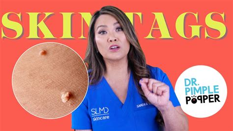 dr pimple popper skin