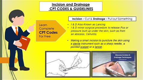 Drainage Catheter Removal Cpt Code