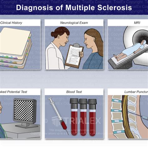 Drug Test For Multiple Sclerosis