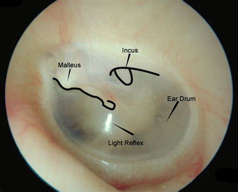 Drum Ear Drum