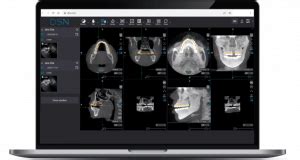dsn dental software