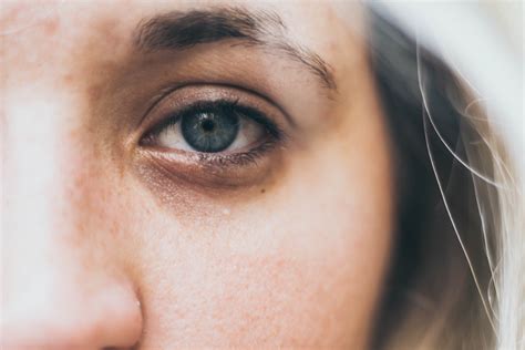 5 Tipps gegen Augenringe DAS hilft wirklich bildderfrau.de