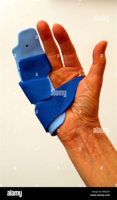 dupuytren's contracture splints for sale