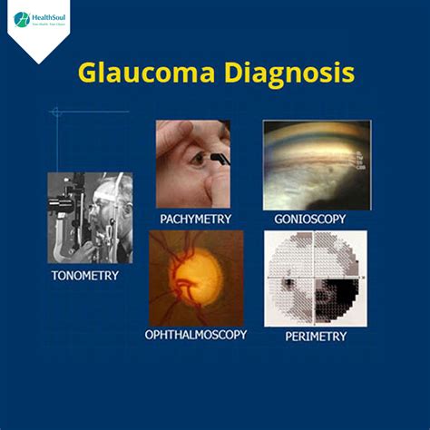 dwp points for glaucoma diagnosis