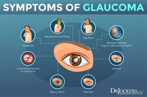 dwp points for glaucoma symptoms