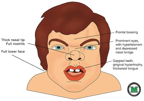 Dysmorphic Face Adalah
