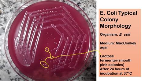 e coli isolated colony