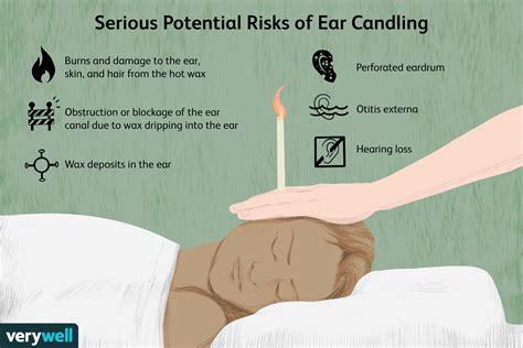 Ear Candle Rules