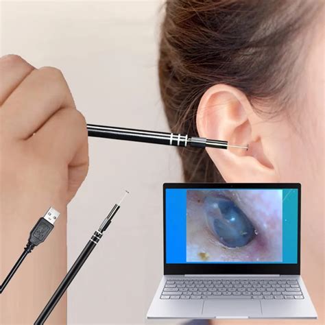 ear cleaning device with camera