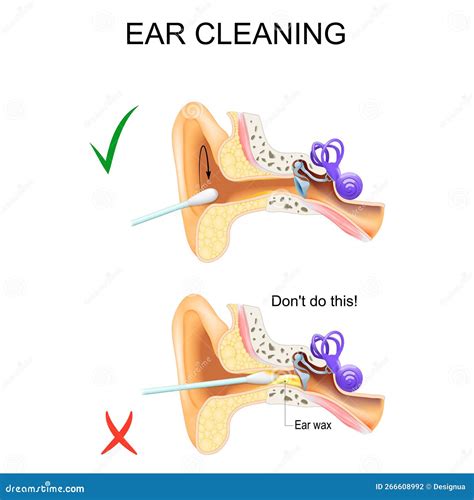 Ear Cleaning Diagram