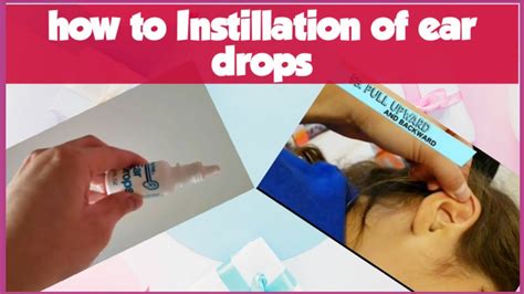 Ear Drop Instillation Technique