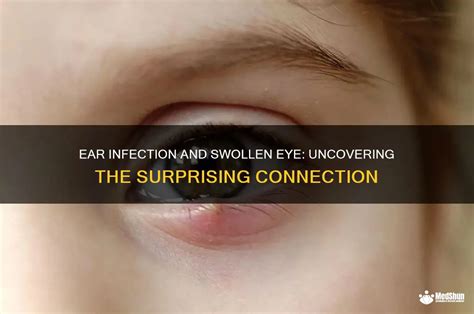 Ear Infection Cause Eye Problems