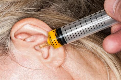 Ear Irrigation Exeter
