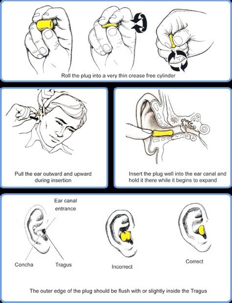 Ear Plug Work For Tinnitus