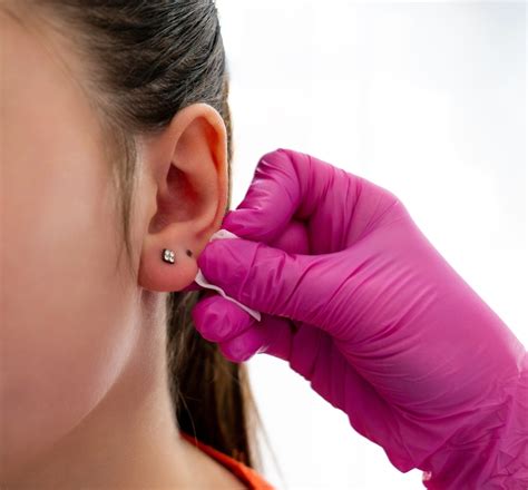 Ear Stud Stuck Inside Earlobe