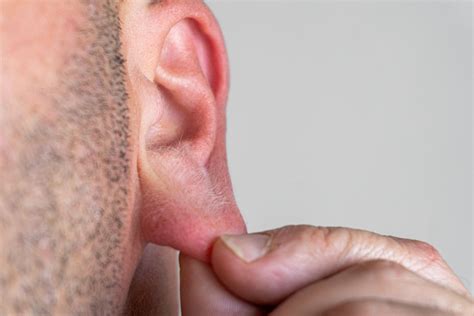 earlobe injury types