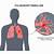 early warning signs of pulmonary embolism