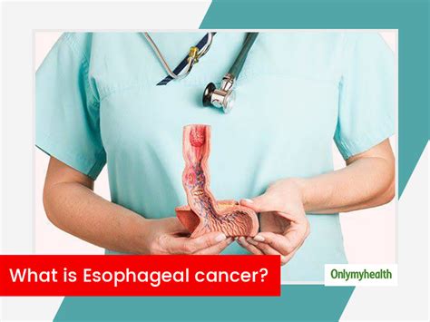 early esophageal cancer treatment