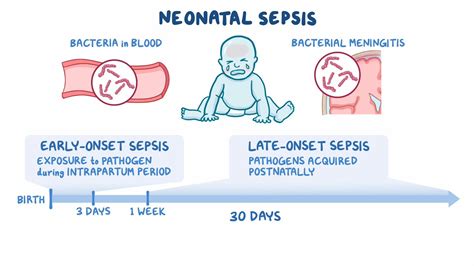 early onset sepsis in neonates