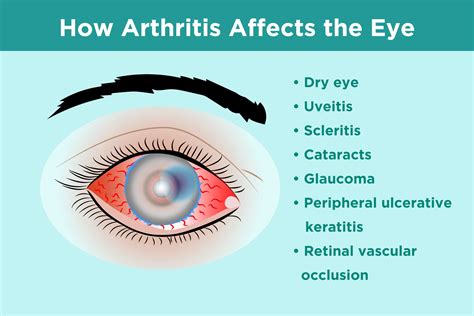 early signs of eye disease