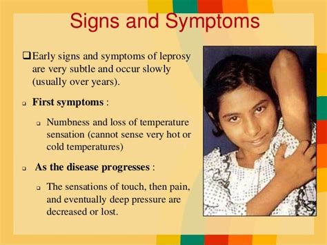 early signs of leprosy