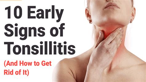 early signs of tonsillitis
