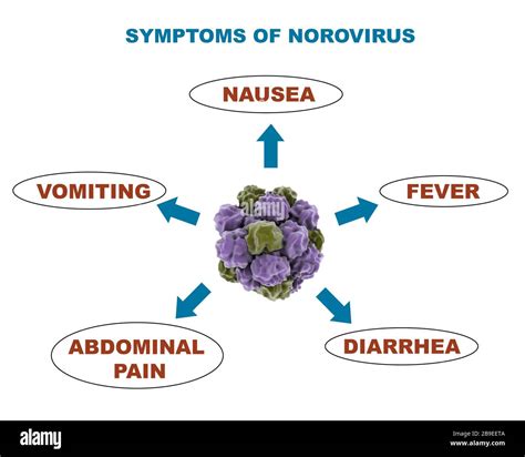 early symptoms of norovirus