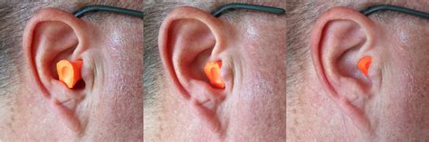 Earplug Pain Ears