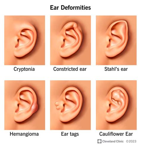 Ears in Good Condition