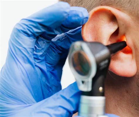 Earwax Removal Guildford