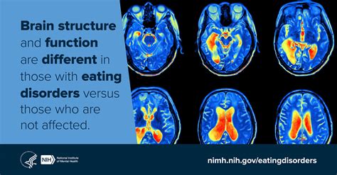eating disorder mind