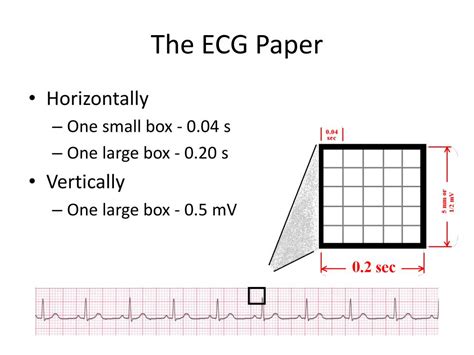 Ecg Box Height