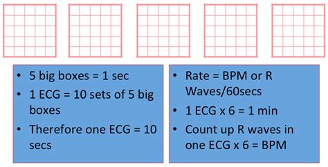 Ecg Box Method