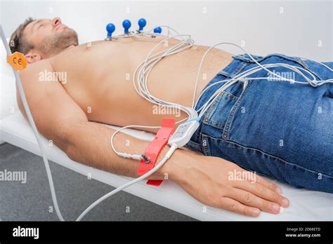 Ecg Electrode Placement Wrist