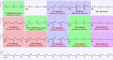 Ecg Leads Not Reading