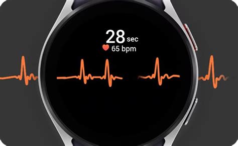 Ecg Smartwatch Samsung