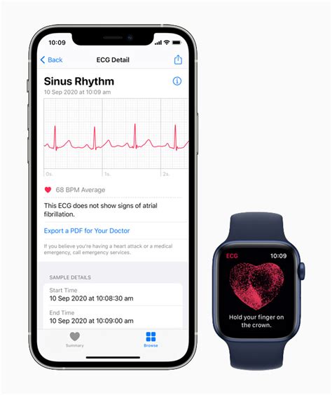  62 Free Ecg Test Apple Watch 6 Popular Now