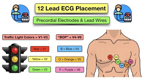 Ecg Test Leads Placement