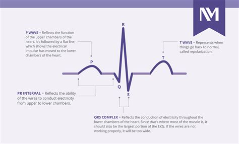 Ecgs Explained