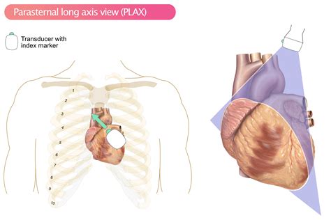 Understanding Echo Transthoracic Complete: A Comprehensive Guide to Heart Imaging