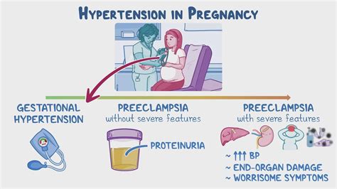 Eclampsia During Labor
